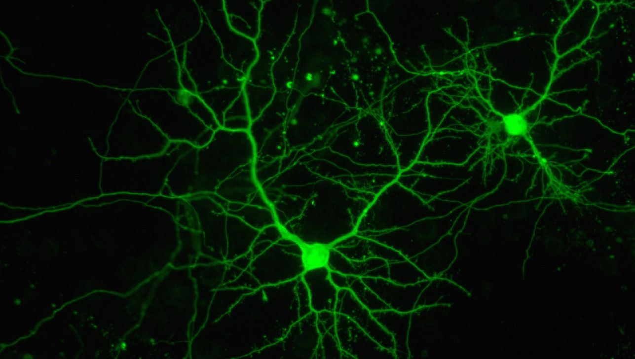 Interneuronas