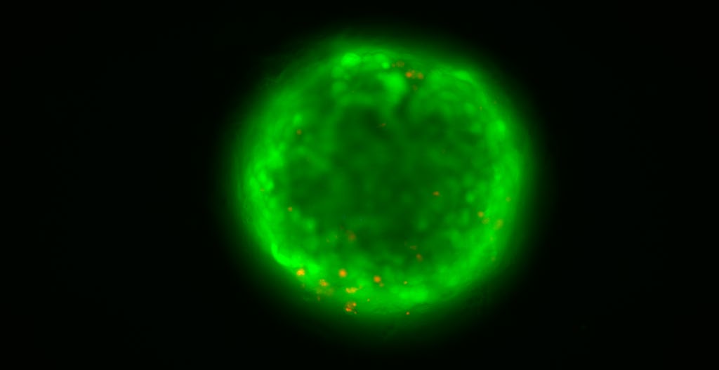 Esferoide de células hepáticas que muestra las células viables (verde) y las no viables (rojo):. / Cinta Porte (IDAEA-CSIC)