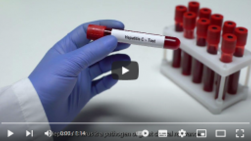 Biosensor para detección de hepatitis C